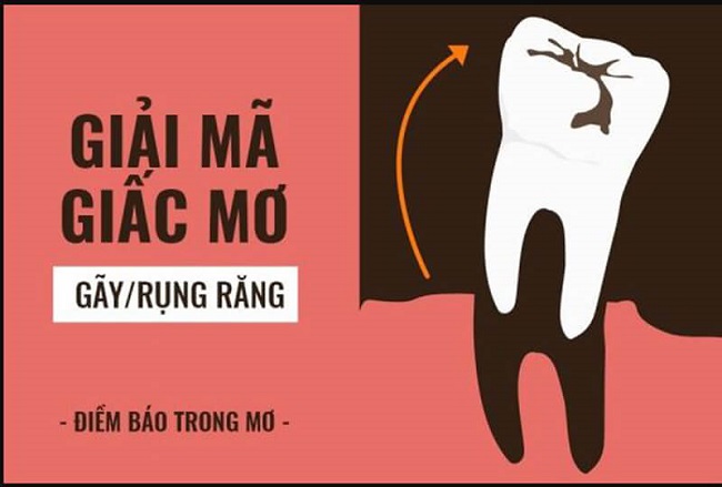 Giải mã nằm mơ thấy rụng răng – Mơ rụng răng đánh số mấy